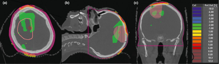 FIG. 3