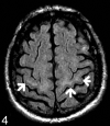 Fig 4.