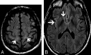 Fig 2.