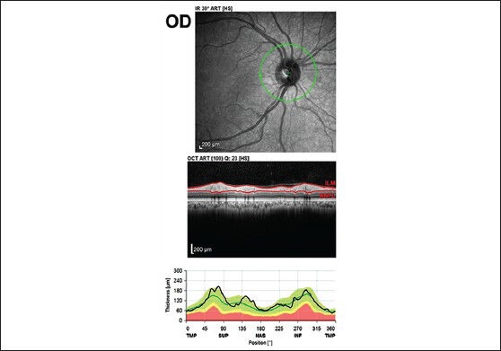 Figure 2a