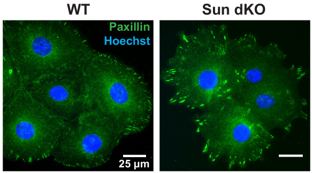 Figure 4—figure supplement 2.