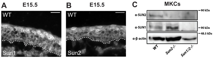 Figure 3—figure supplement 1.