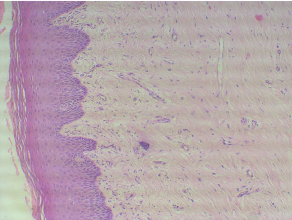 Figure 1: Shows normal buccal mucosa with loose fibrillar collagen towards the basement membrane and dense collagen bundles in the deeper lamina propria. (H&E stain-10X)