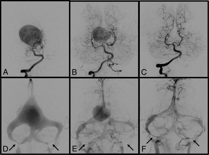 Fig 2.