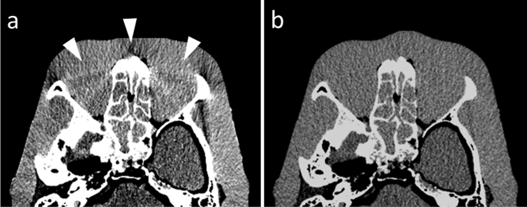 Fig. 7