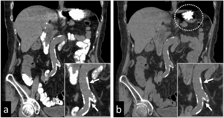 Fig. 17