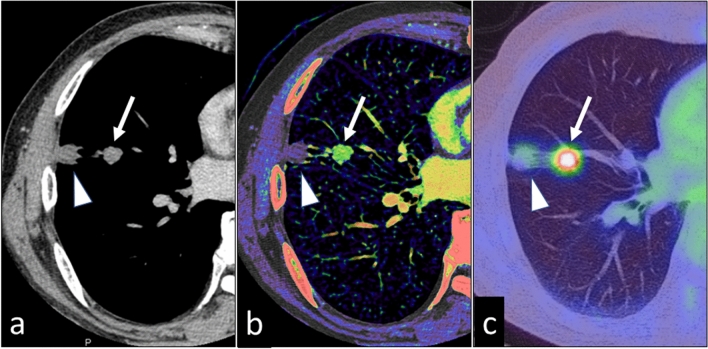 Fig. 14