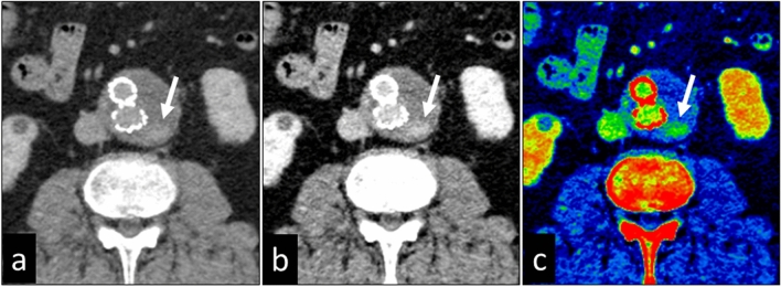 Fig. 16