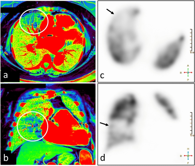 Fig. 13