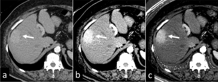 Fig. 9