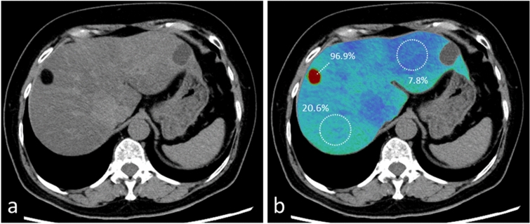 Fig. 19