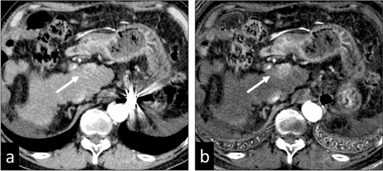 Fig. 10