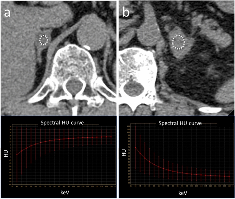 Fig. 12