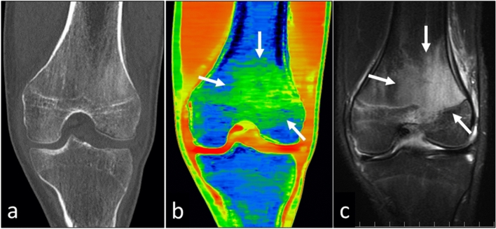 Fig. 18