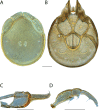 Figure 112.