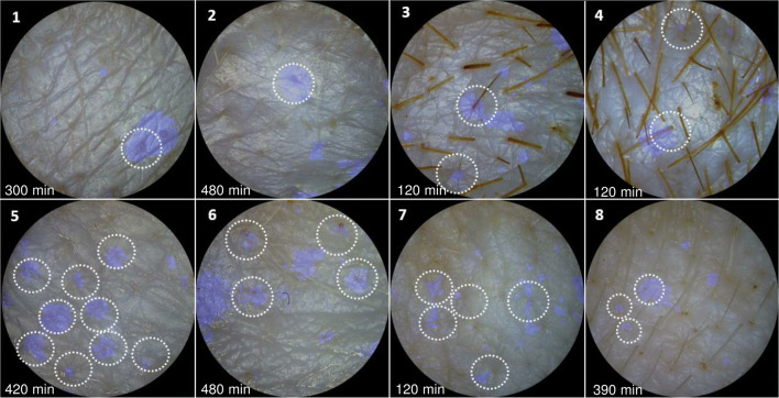 Fig. 4