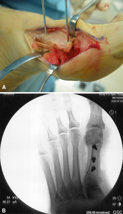 Fig. 2A–B