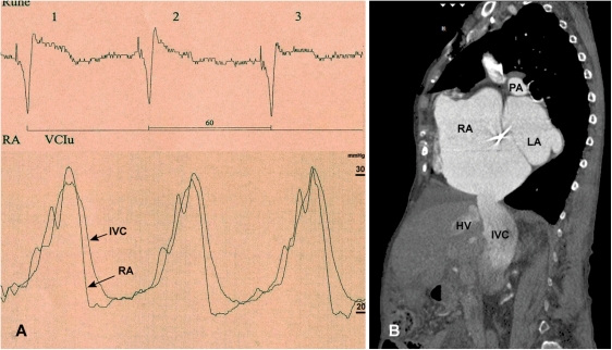 Figure 1