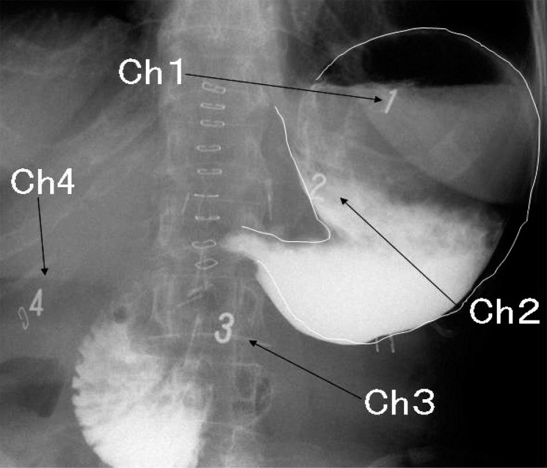 Fig. 2.