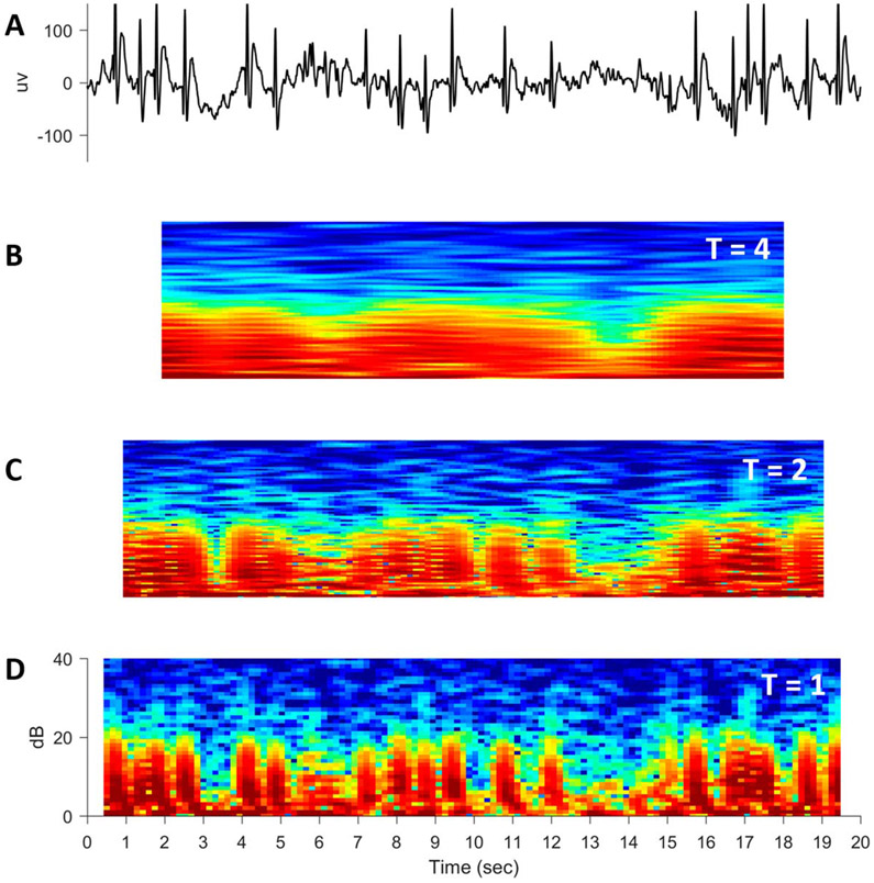 FIG. 12.