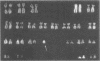 178