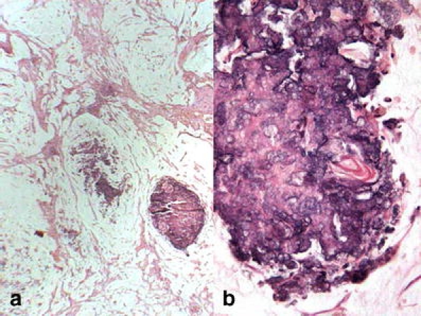 Fig. 5