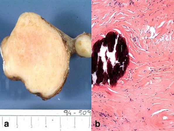 Fig. 11