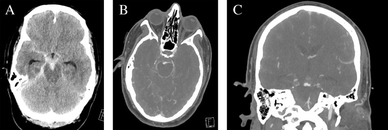 Fig. 1 –