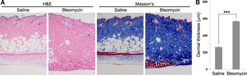 Fig. 13.