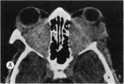 FIGURE 12 A