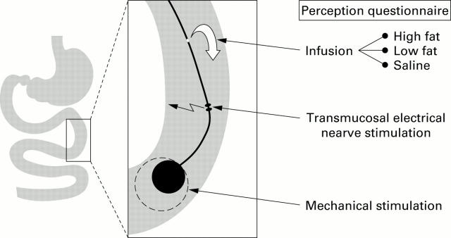 Figure 1  