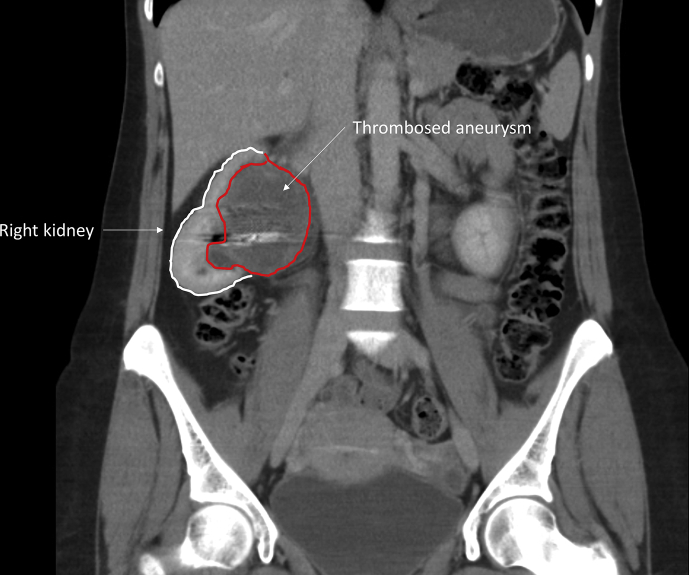 Figure 3