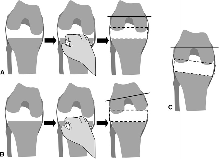 Fig. 1A–C