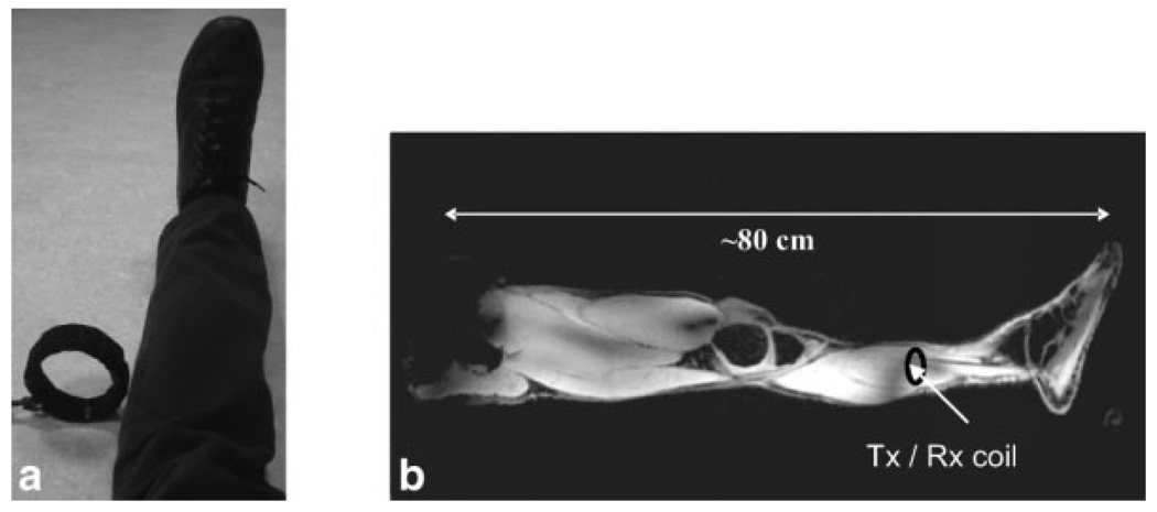 FIG. 1