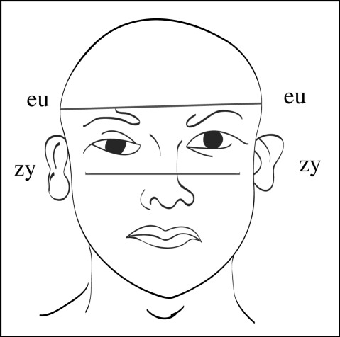 Figure 1b :