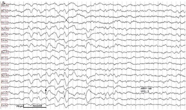 Figure 5