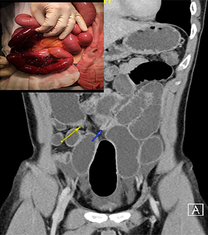 Fig. 3