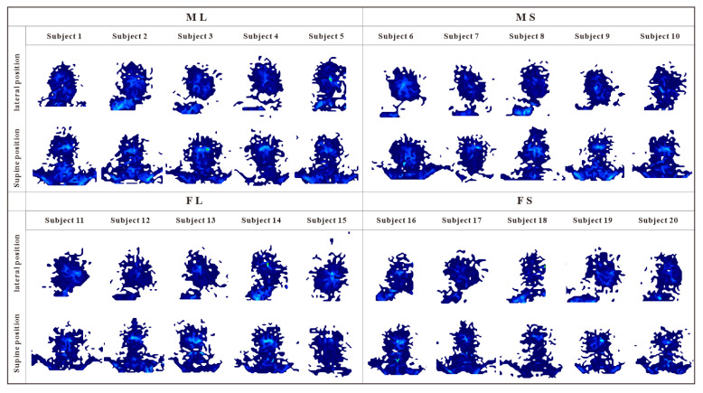 Figure 11