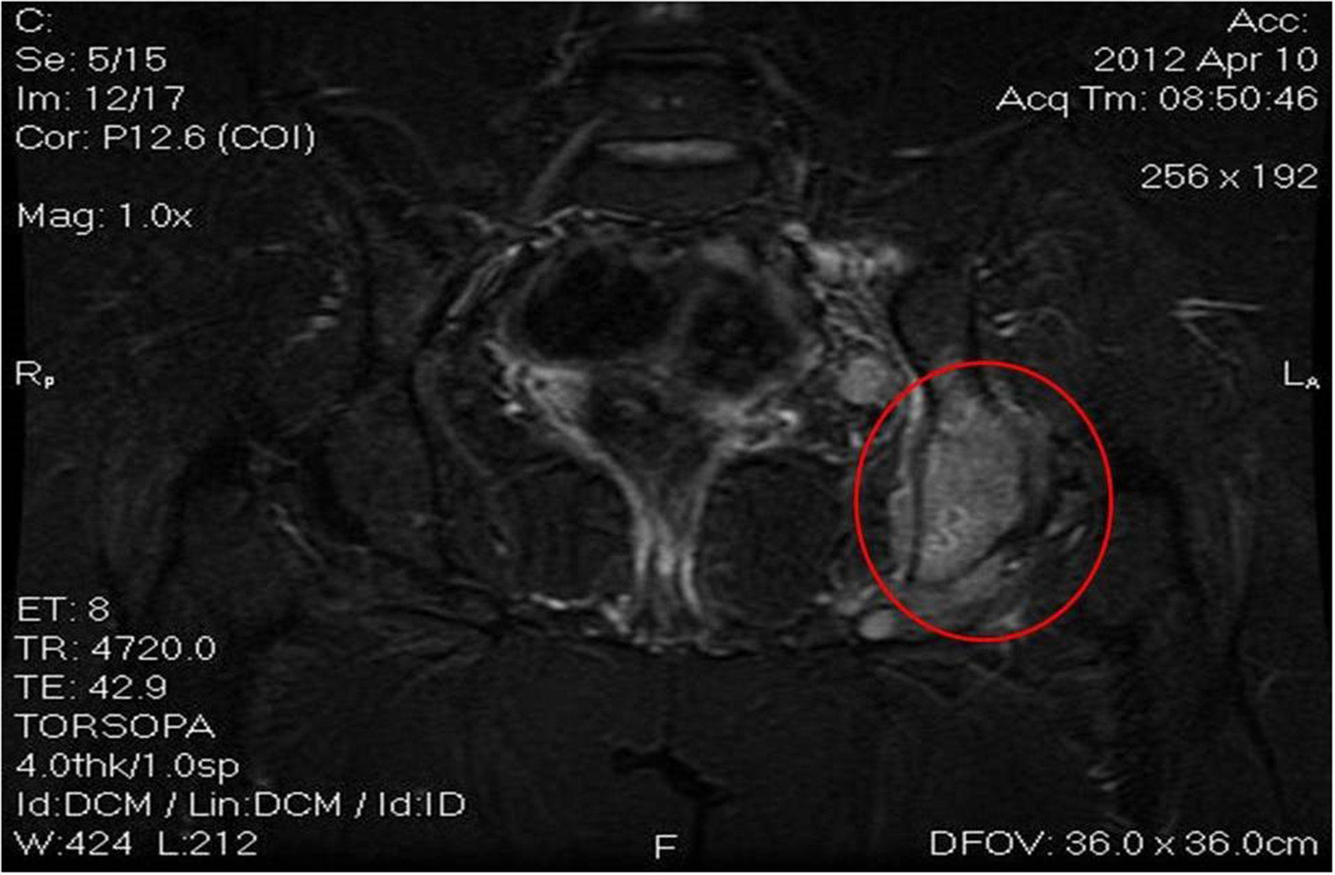 Images 5A, 5B and 5c.