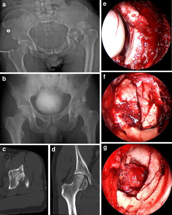 Fig. 1