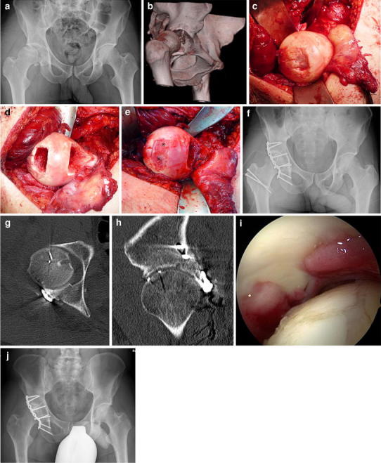 Fig. 2