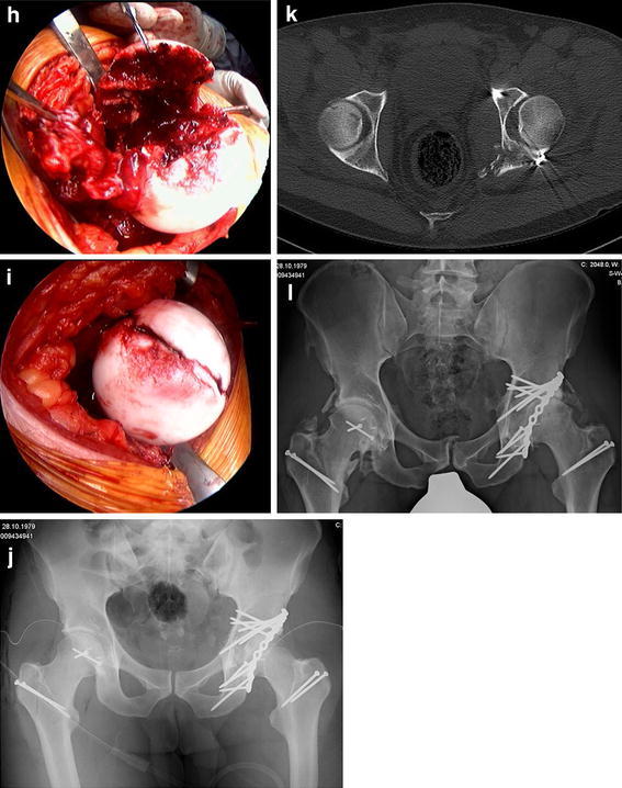 Fig. 1