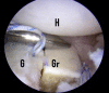 Fig 9