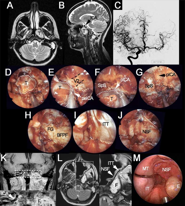 Figure 1