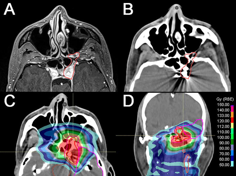 Figure 2