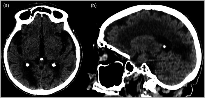 Figure 5.