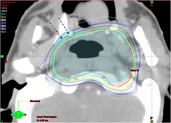 Fig. 3