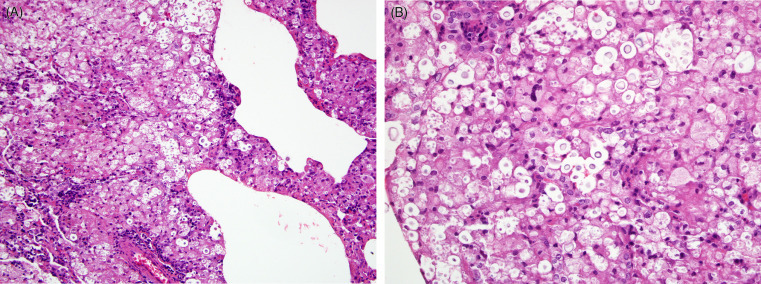 Figure 20.15