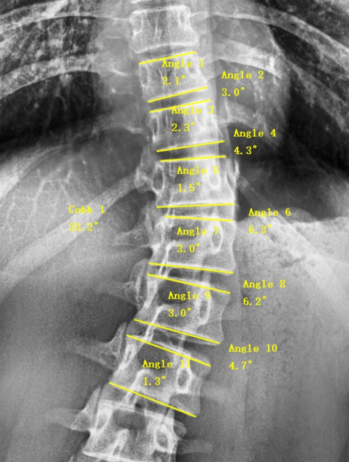 Fig. 1