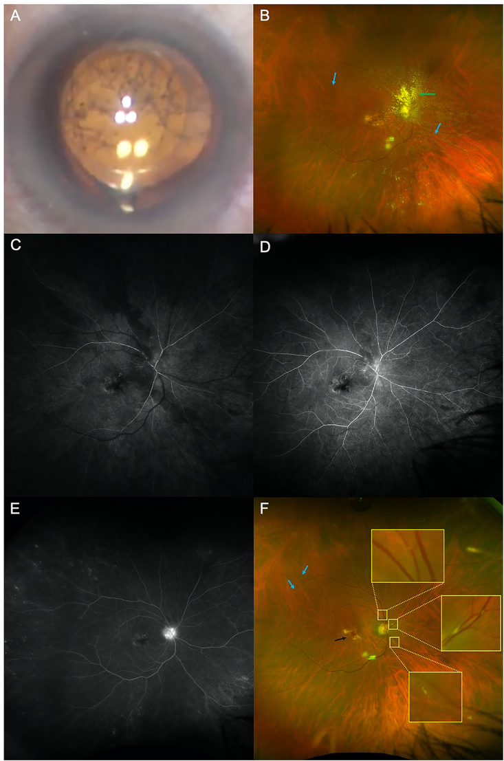 Fig. 2